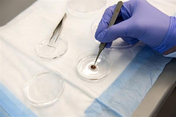 明尼蘇達大學的3D生物打印補丁可修復受損的心臟細胞