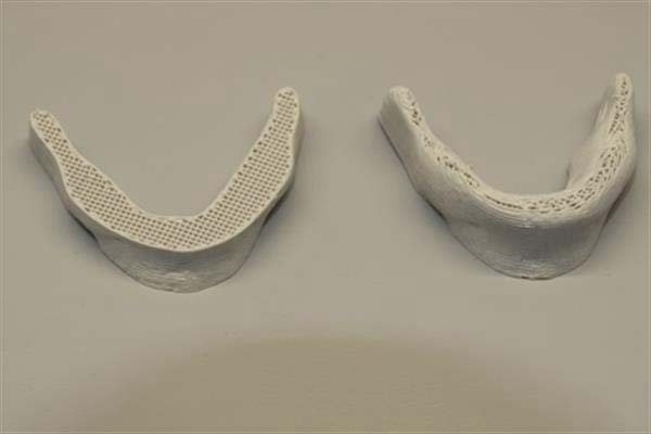 基于纖維素的新型環保3D打印墨水可制造植入物和假體
